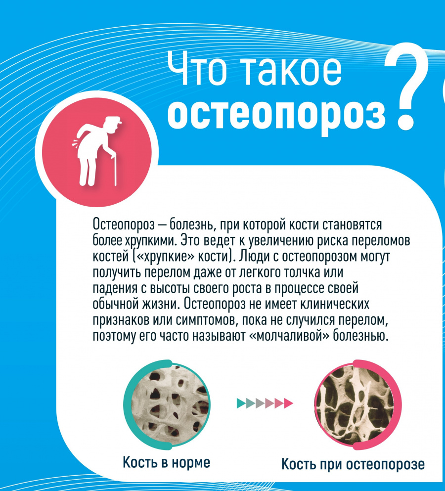 Что такое остеопороз? Что такое остеопороз?